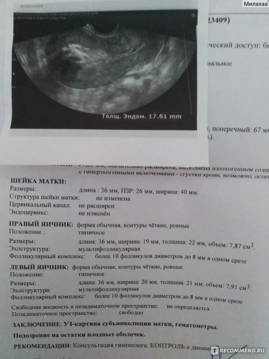 Сколько дней выделения после выскабливания. Показатели УЗИ после родов. УЗИ после родов норма. УЗИ послеродовой матки. УЗИ матки после родов норма.