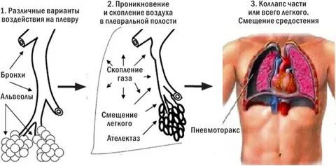 Почему в батарее постоянно скапливается воздух