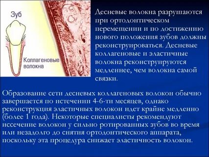 Эластичные волокна 6