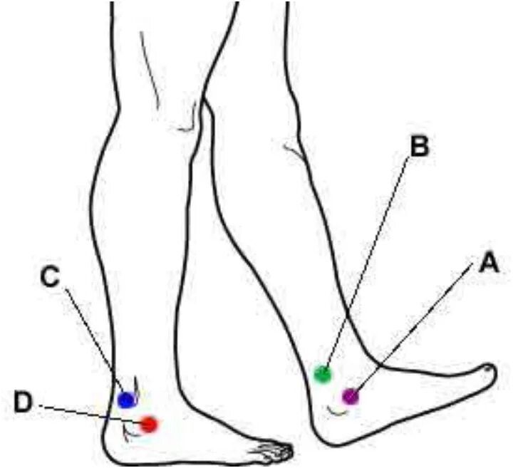 Акупунктурные точки на голеностопе. Триггерные точки голеностопа. Акупунктура точки на щиколотке. Болевые точки на лодыжке.
