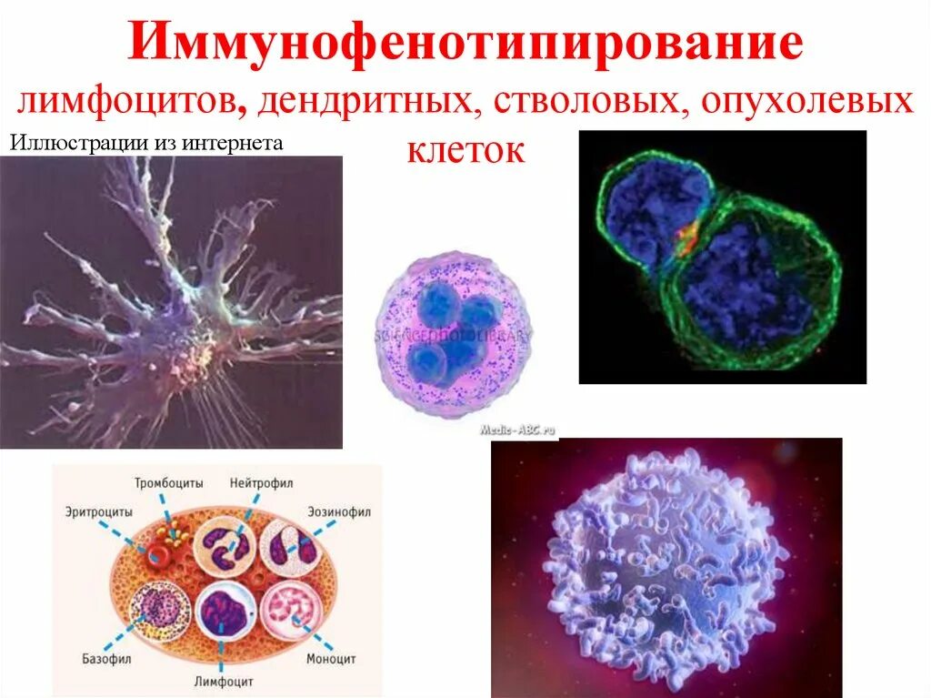 Иммунофенотипирование клеток иммунной системы. Основной метод иммунофенотипирования лимфоцитов это. Иммунофенотипирование острых лейкозов. Иммунофенотипирование лимфоцитов периферической крови. Cd19 лимфоциты