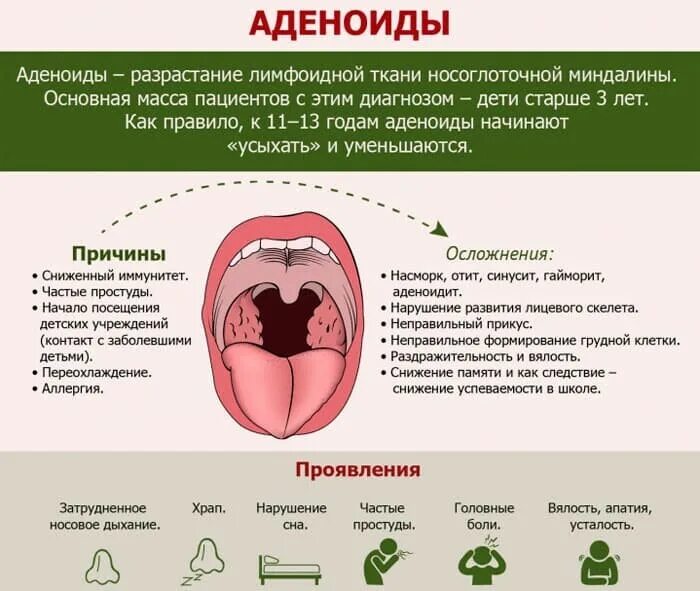 Аденоиды у ребенка 2 3 лет. Увеличением объема лимфоидной ткани (аденоиды),. Аденоидит у детей признаки.