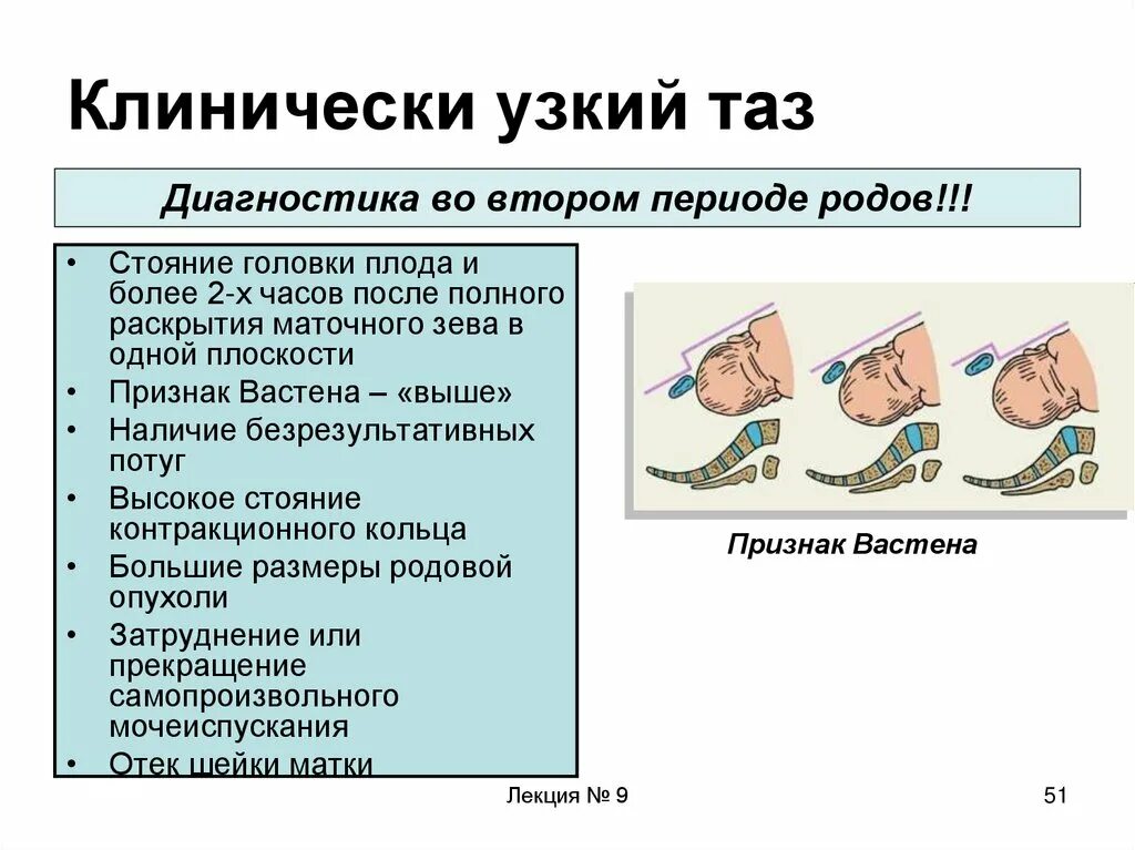 Кесарево узкий таз. Роды при клинически узком тазе. Rkbybxtcrb eprbq NFP. Клинический узкий таз условия.