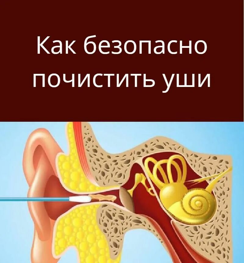 Как быстро почистить ухо. Как безопасно чистить уши. Как правильно чисто уши. Как очистить уши от серы.