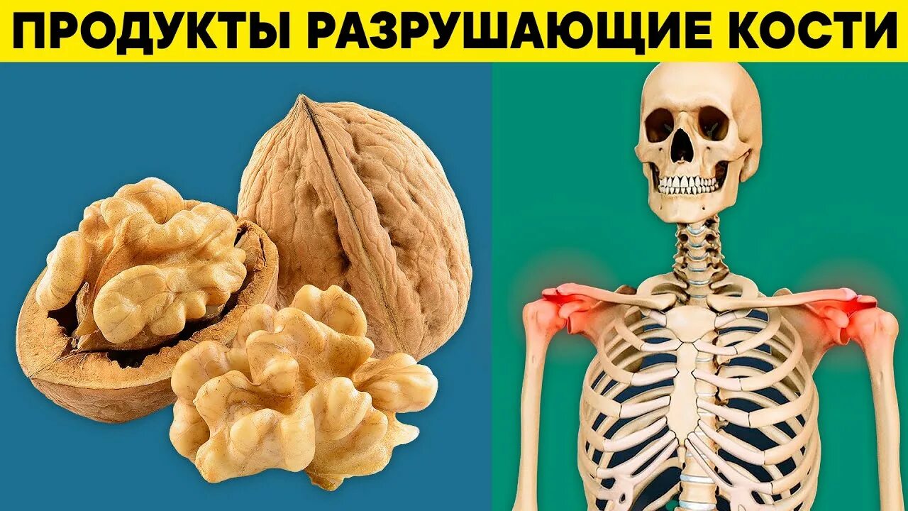 Продукты разрушающие кости. Еда для костей. Продукты, опасные для костей. Продукты для укрепления костей. Пища разрушить