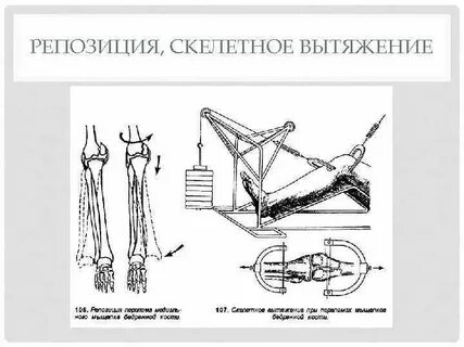 Репозиция это