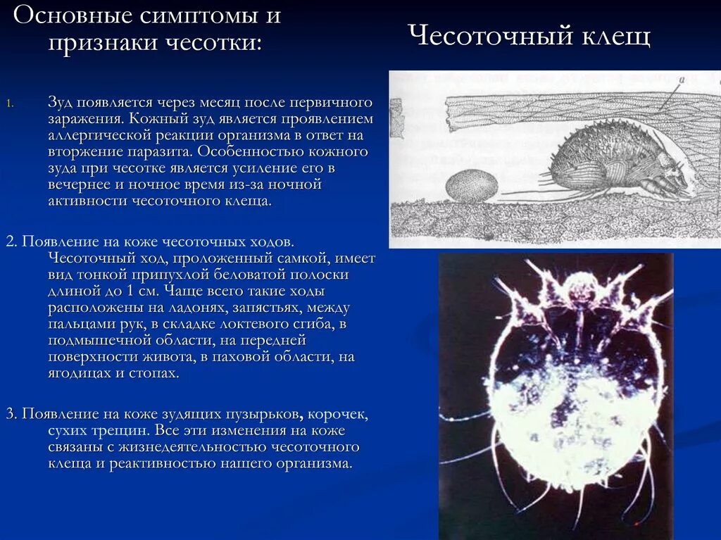 Сколько живет чесоточный. Чесоточный зудень возбудитель заболевания. Чесоточный клещ чесотка. Патогенез чесоточного зудня. Чесоточный зудень (Sarcoptes scabiei).