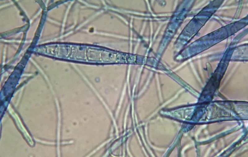 Грибы дерматофиты у людей как выглядит Candida albicans toxin plays a special role in the colonization of the digestive