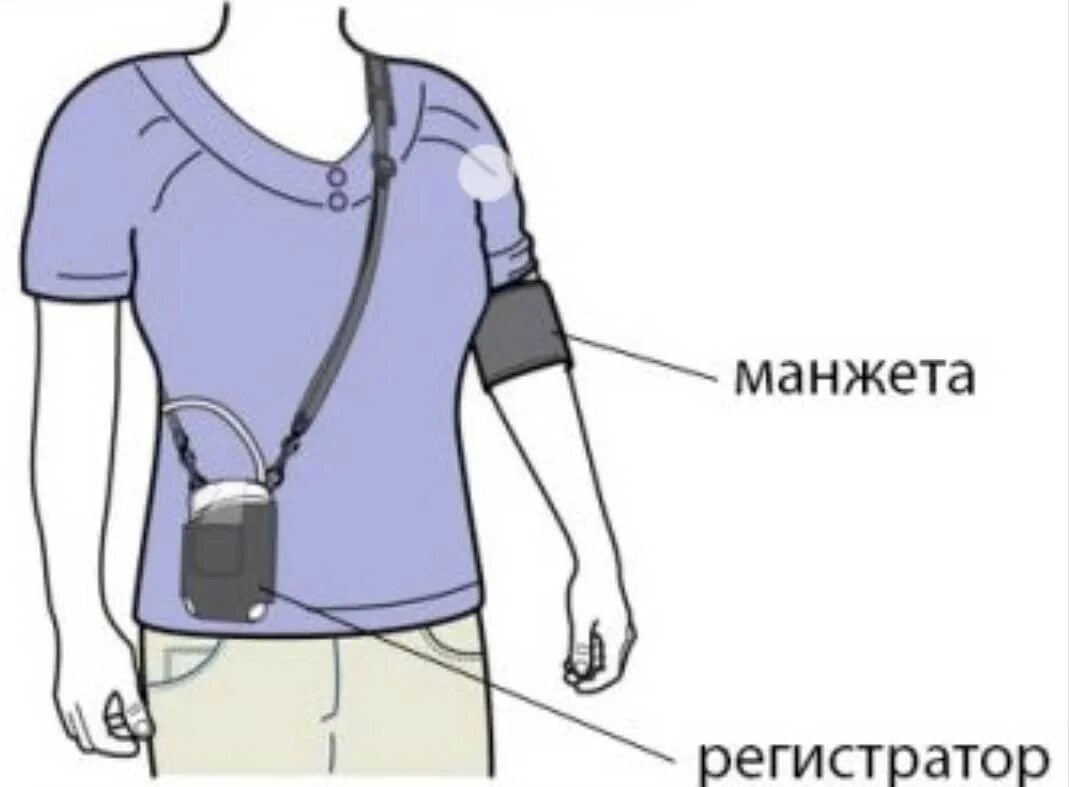 Суточный мониторинг артериального давления. Суточное измерение артериального давления прибор. Смад: мониторинг давления. Суточный монитор ад — аврм-04. Холтеровское мониторирование ад.