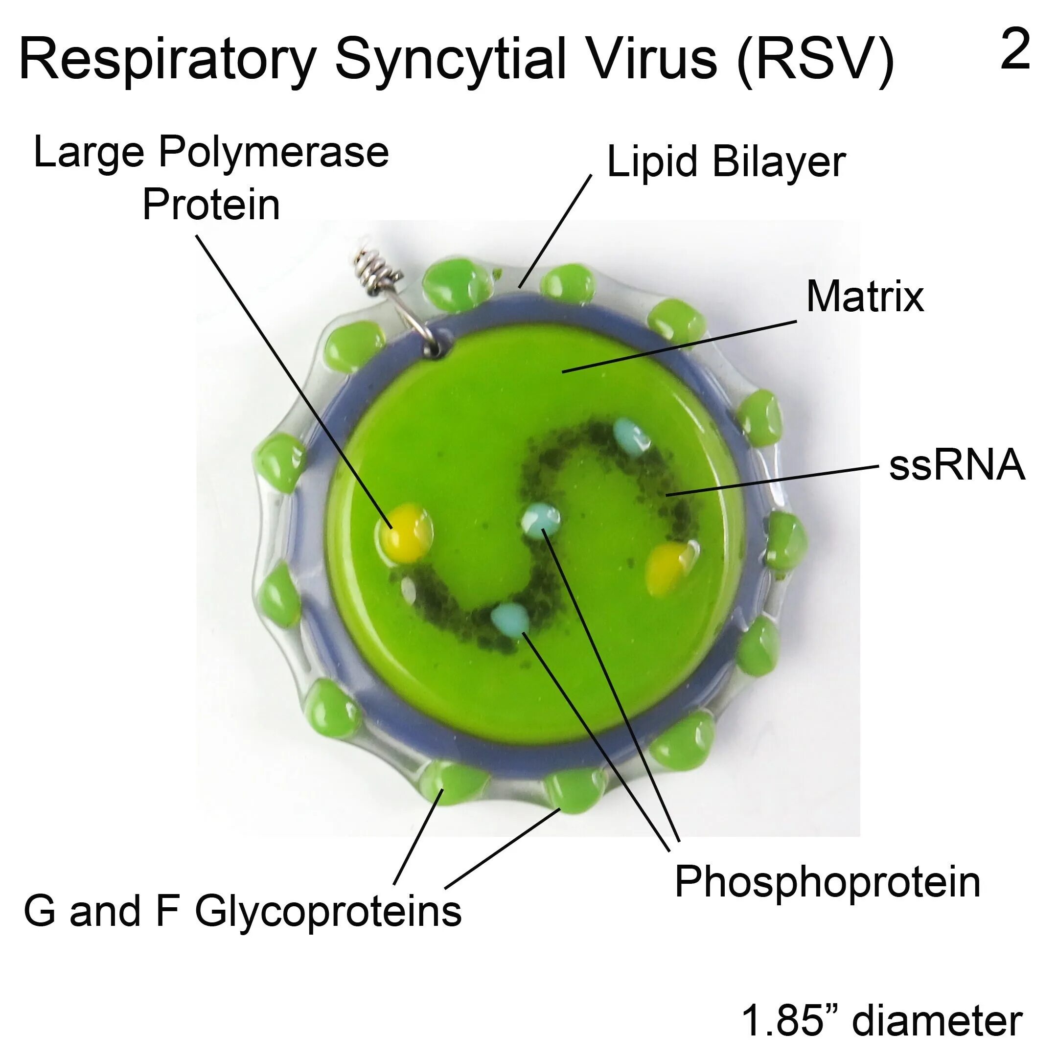 Syncytial virus. Respiratory syncytial virus. Respiratory syncytial virus Infectious disease. РСВ вирус кт картина.