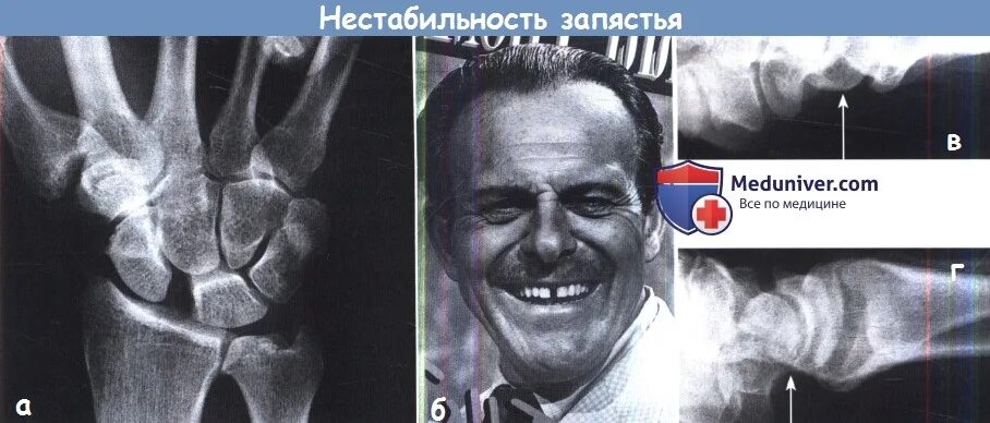 Признаки нестабильности в сегменте