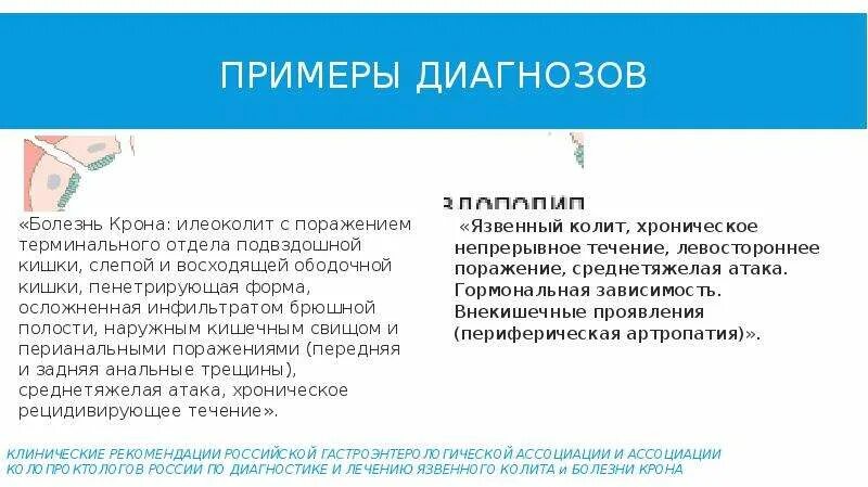 Болезнь крона тест с ответами. Язвенный колит формулировка диагноза. Язвенный колит пример диагноза. Болезнь крона пример диагноза. Образцы диагноза язвенного колита.