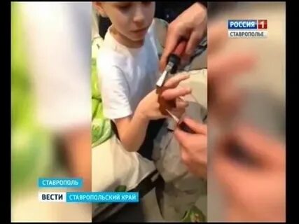 Мальчику оторвало 3 пальца