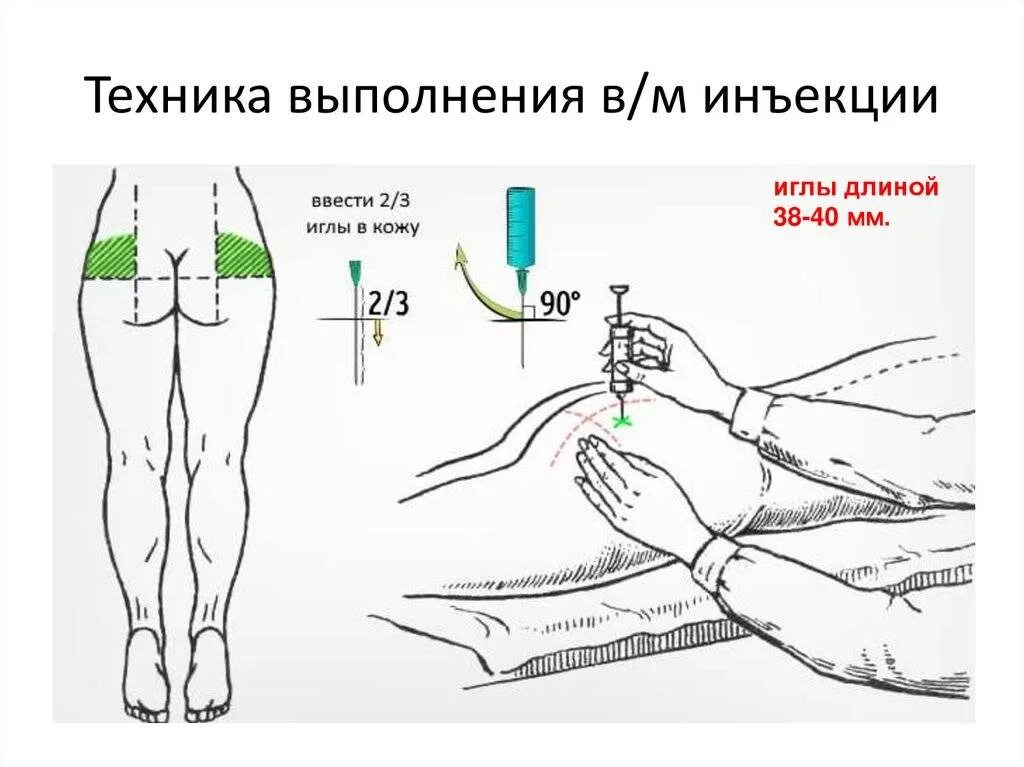 Алгоритмы введения лекарственных препаратов