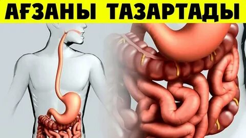 Каловая интоксикация