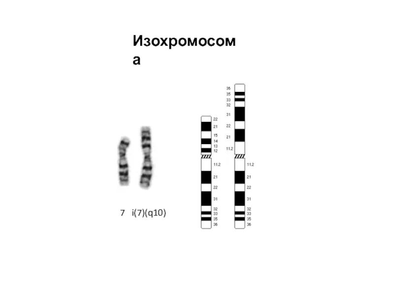 Дицентрические хромосомы. Изохромосомы. Образование изохромосом. Дицентрические и кольцевые хромосомы. Кольцевая хромосома 1