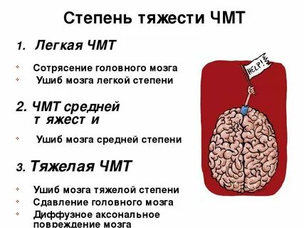 2 степень мозг