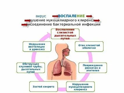 Воспаление дыхательных путей у ребенка