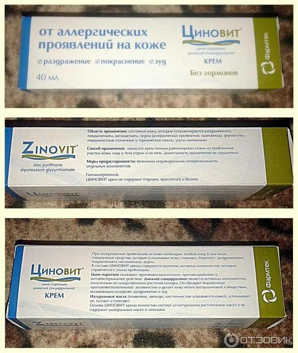 Мазь от раздражения кожи на лице. Циновит крем зеленая дубрава. мазь от раздражения кожи. мазь от раздражения на лице. мазь для кожи от зуда и шелушения раздражения.