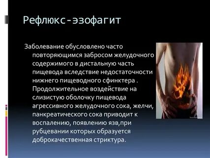 Как вылечить рефлюкс эзофагит навсегда