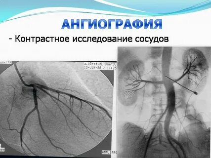 Исследование артерий