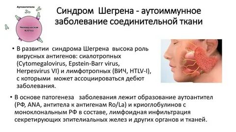 Болезнь зав