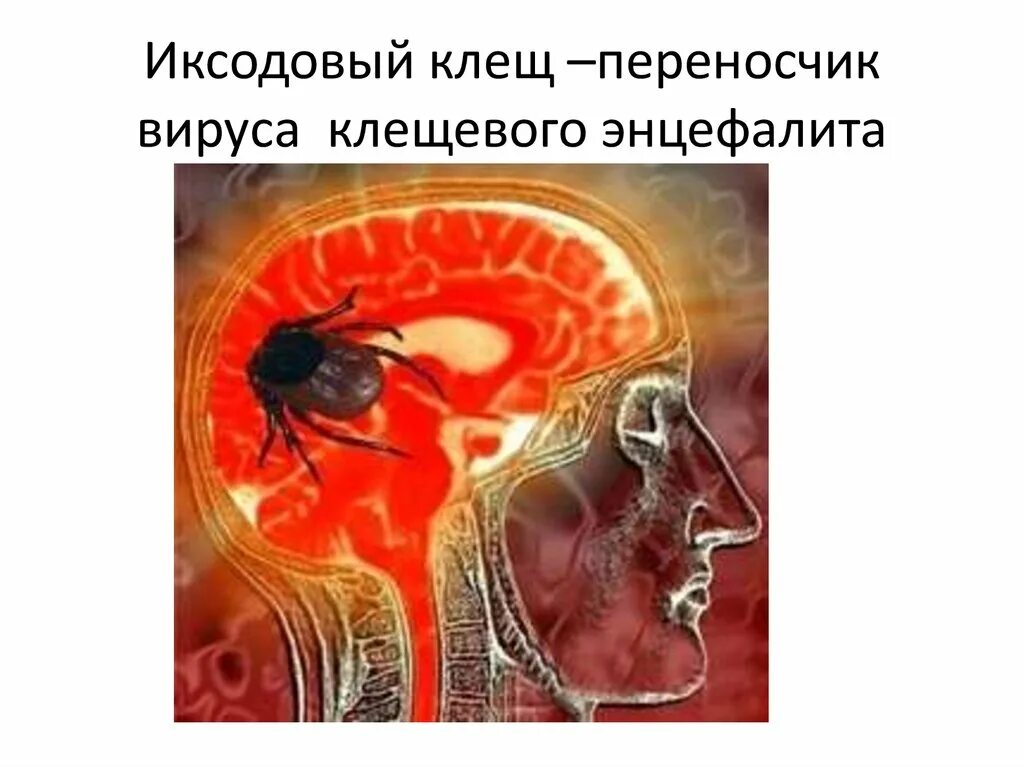 Переносчики вируса клещевого энцефалита. Вирус клещевого энцефалита. клещи и вирус клещевого энцефалита. переносчик вируса энцефалита. клещевой вирусный энцефалит.