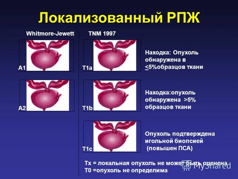 рак предстательной железы форум