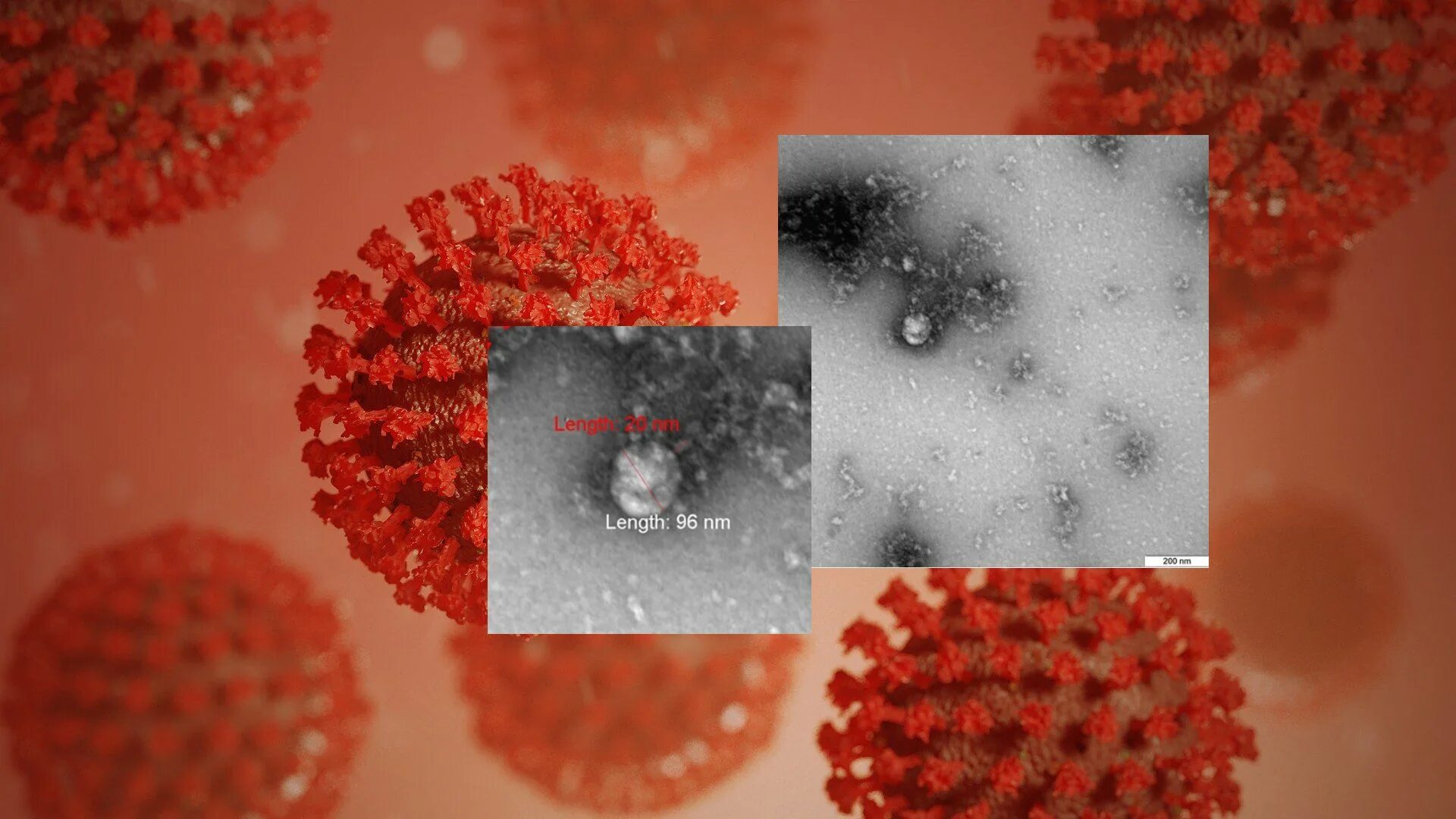 вакцина против covid-19. тема коронавирус. приближается новый вирус-школовирус. илья акинфеев врач-инфекционист. непонятный вирус в москве.
