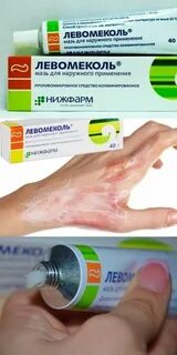Аптека мазь левомеколь