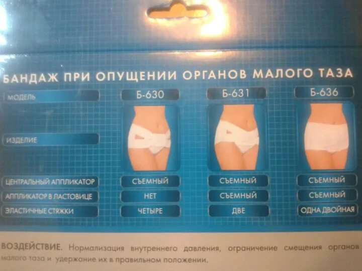 Опущение органов малого таза у женщин операция. Живот при опущении внутренних органов. при опущении органов малого таза у женщин. опущенные органы малого таза.