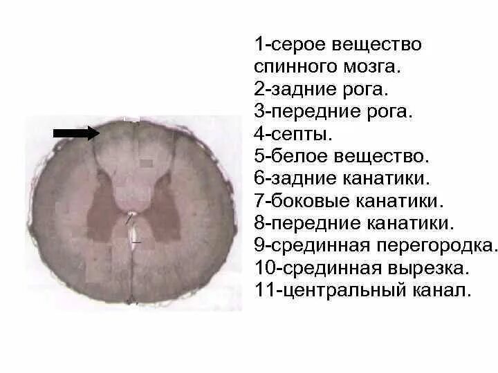 Передние рога серого вещества. Передние рога серого вещества