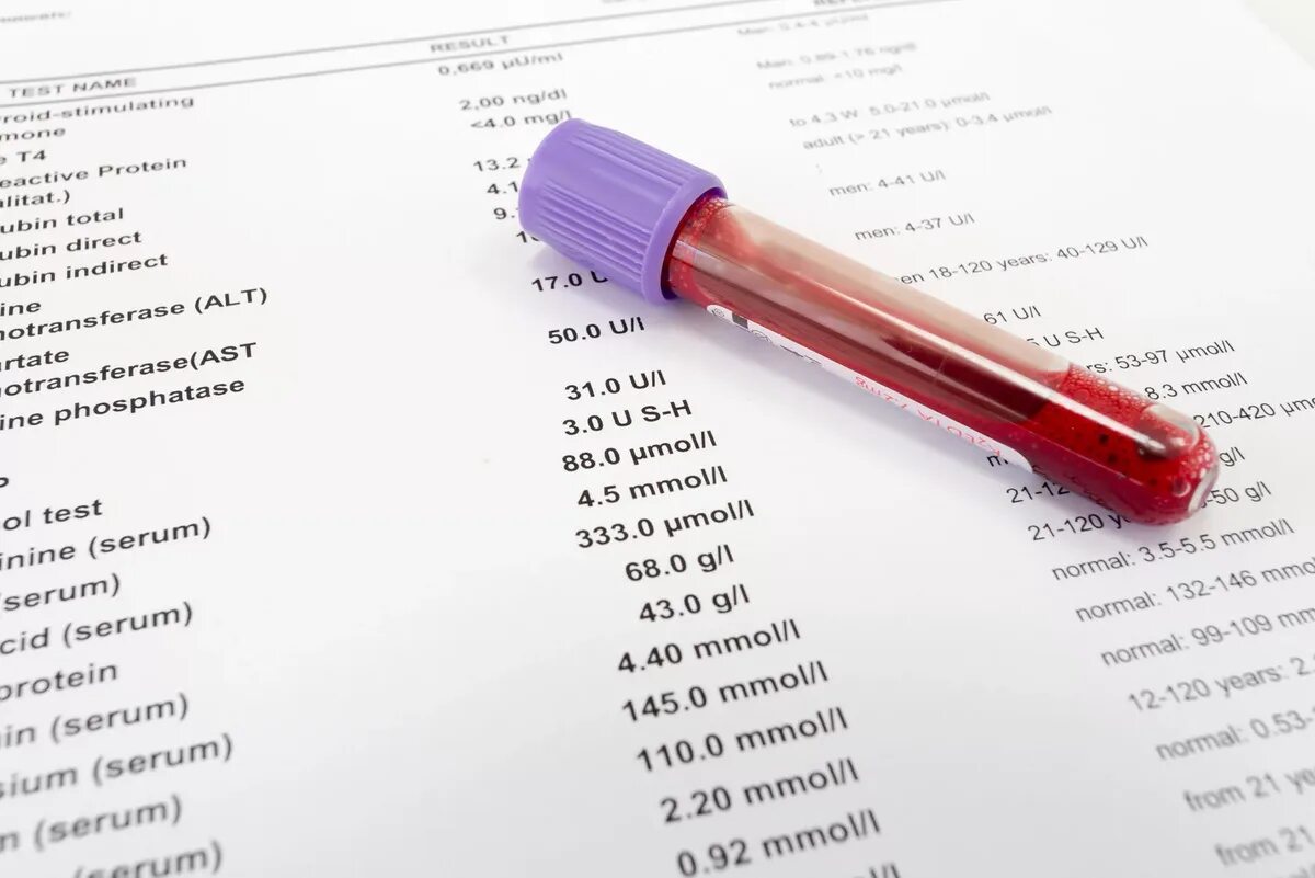Тест на наличие крови. Анализ крови. Исследование анализа крови. Биохимическое исследование крови. Анализы рои.