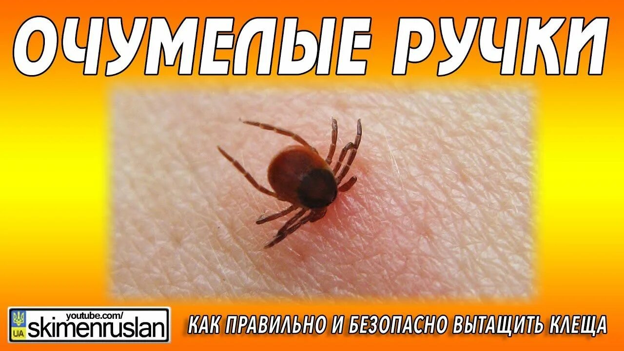 Как вытащить клеща у собаки пинцетом. Как вытащить клеща у собаки пинцетом