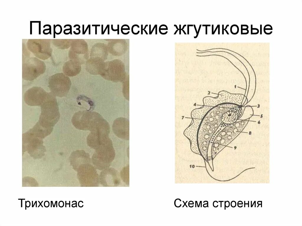 Рассмотрите изображение паразитического простейшего какое заболевание