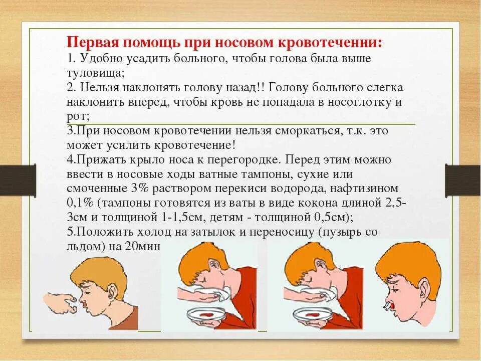 Что сделать при носовом кровотечении ответ. Первая доврачебная медицинская помощь при носовых кровотечениях. алгоритм оказание пп при носовом кровотечении. последовательность оказания первой помощи при носовом кровотечении. как оказать первую помощь пострадавшему при носовом кровотечении.