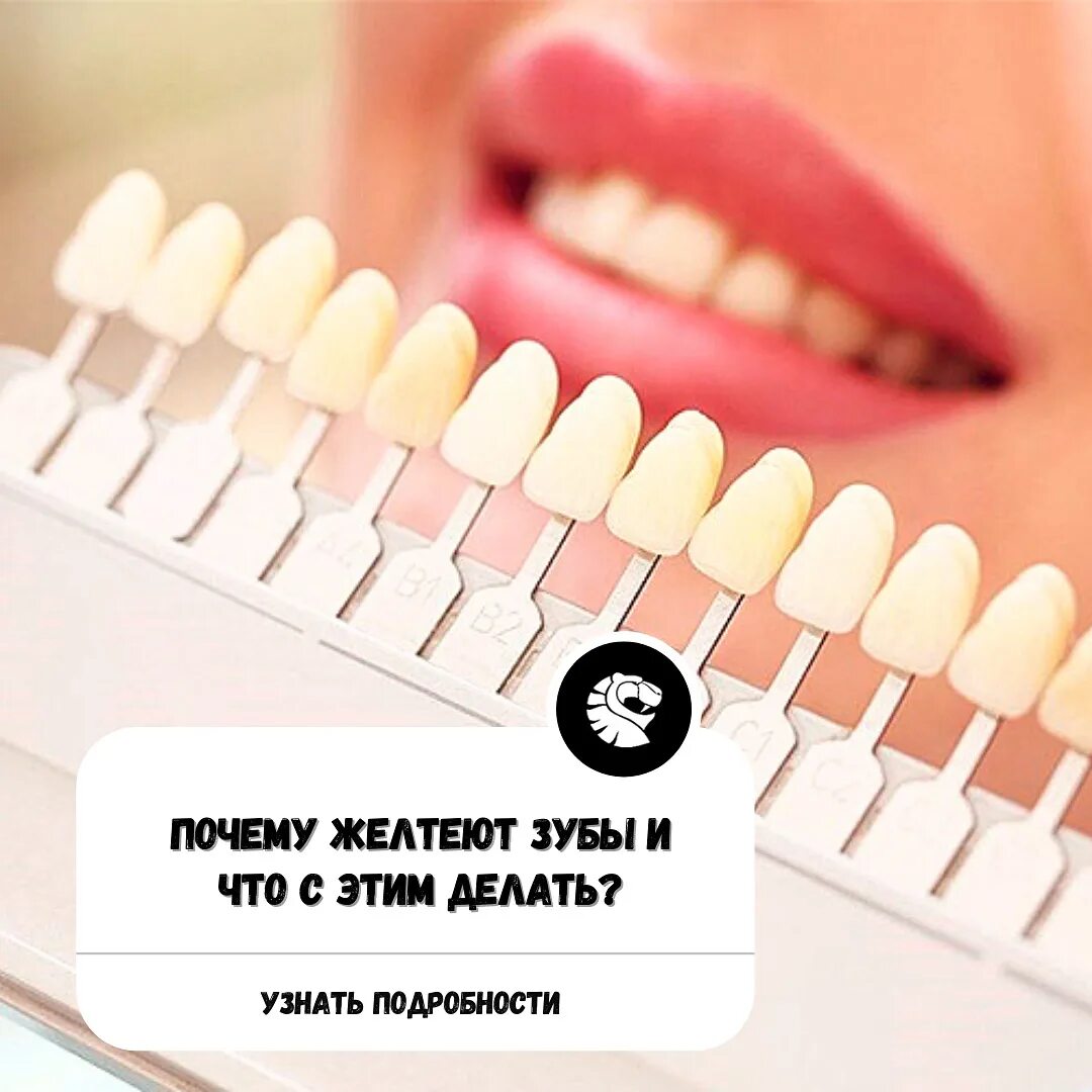 Почему желтеют зубы у женщины. Почему желтеют зубы у женщины. Почему желтеет эмаль зубов. Причины пожелтения зубов. Причины пожелтения зуба.