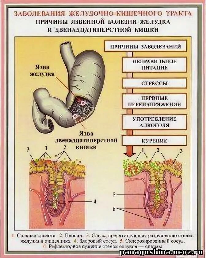 Причины пищеварительных заболеваний. Болезни желудочно-кишечной системы в острой стадии. Профилактика кишечно желудочного тракта памятка. Заболевание желудок кишечного тракта. Заболевания желудочнокигечного тракта.