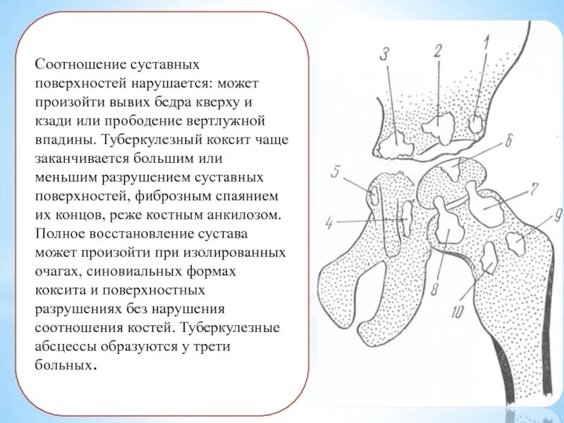 Полное расхождение суставных. Соотношение суставных поверхностей не нарушено. соотношение суставных головок и ямок. резорбция костной ткани вертлужной впадины. гладкие пластинки вертлужных впадин.