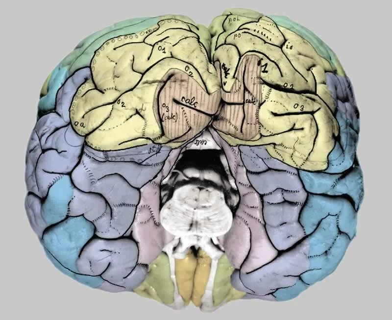 Недоразвитие зон мозга. Анатомия головного мозга атлас. Головной мозг анатомия Синельников. Отделы мозга вид сверху. Атлас коры головного мозга.