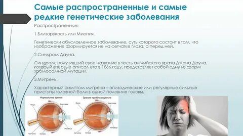Самые распространенные заболевания глаз