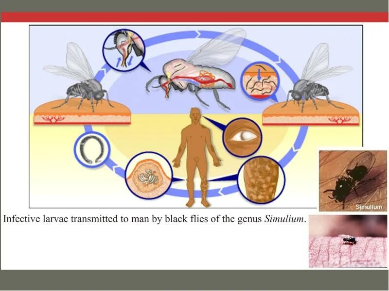 Можно ли считать комара промежуточным хозяином. Нематоды строение тела. Насекомые промежуточные хозяева. Жизненный цикл нематоды с комаром. Simulium переносят.