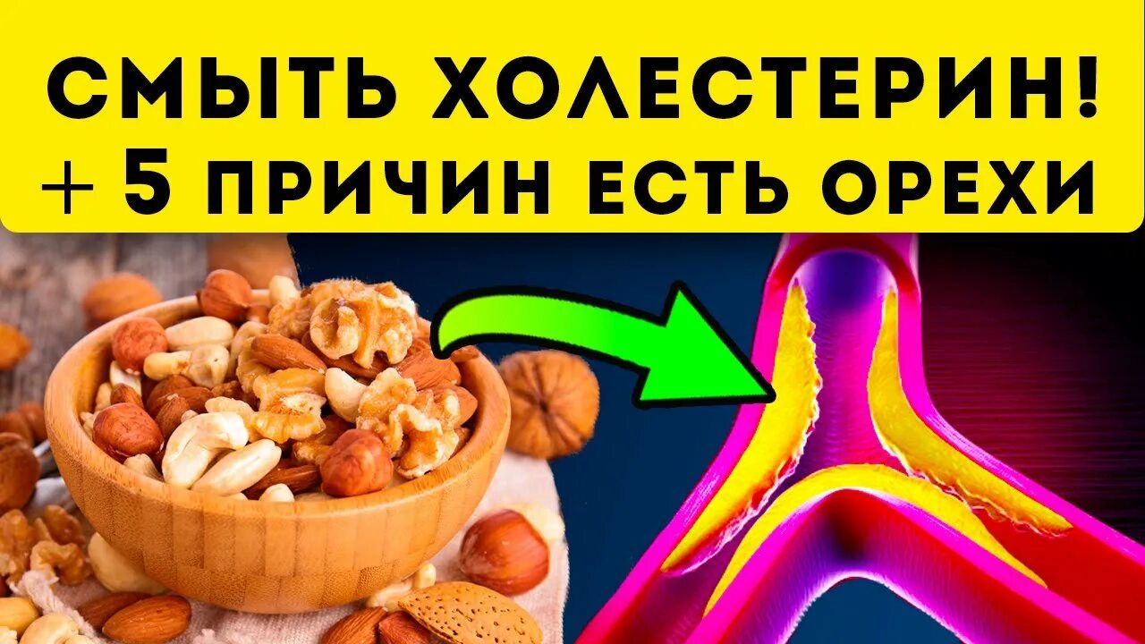 Орехи и холестерин. Орехи от холестерина. Холестерин в орехах. Орехи повышают холестерин. Холестерин от орехов.