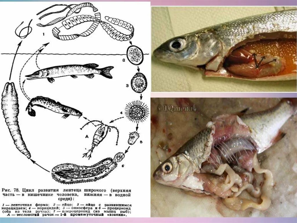 Личинки лентеца. Плероцеркоид дифиллоботриоза. Жизненный цикл широкого лентеца схема. Цикл развития широкого лентеца схема.
