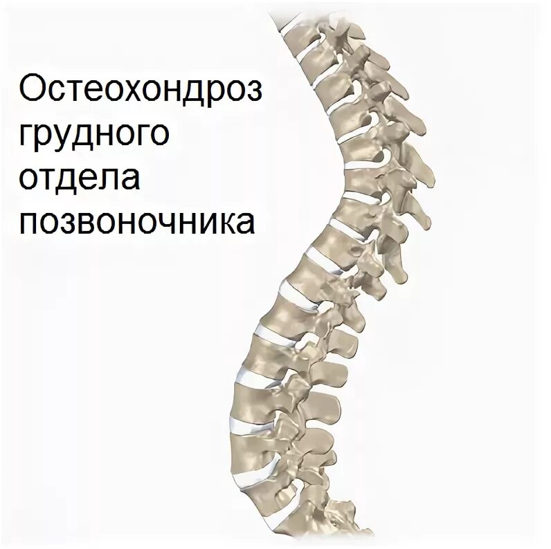 Грудной отдел позвоночника таблетки