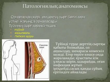 Әртүрлі сүт бездерінің порнофотосуреттері