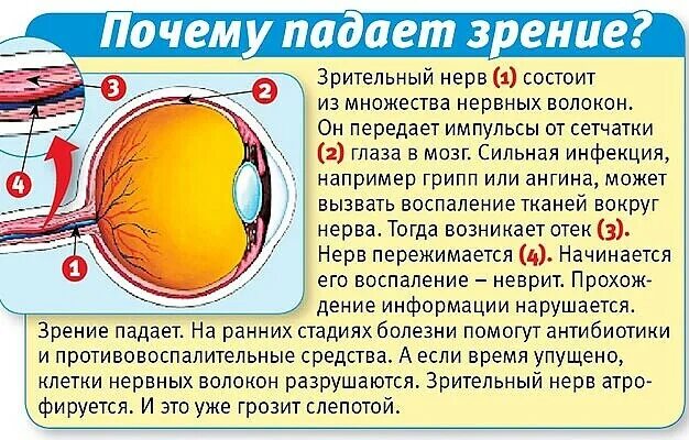 Падает зрение причины. Почему снижается зрение. Причина резкого падения зрения. Почему ухудшается зрение. Плохо вижу читать