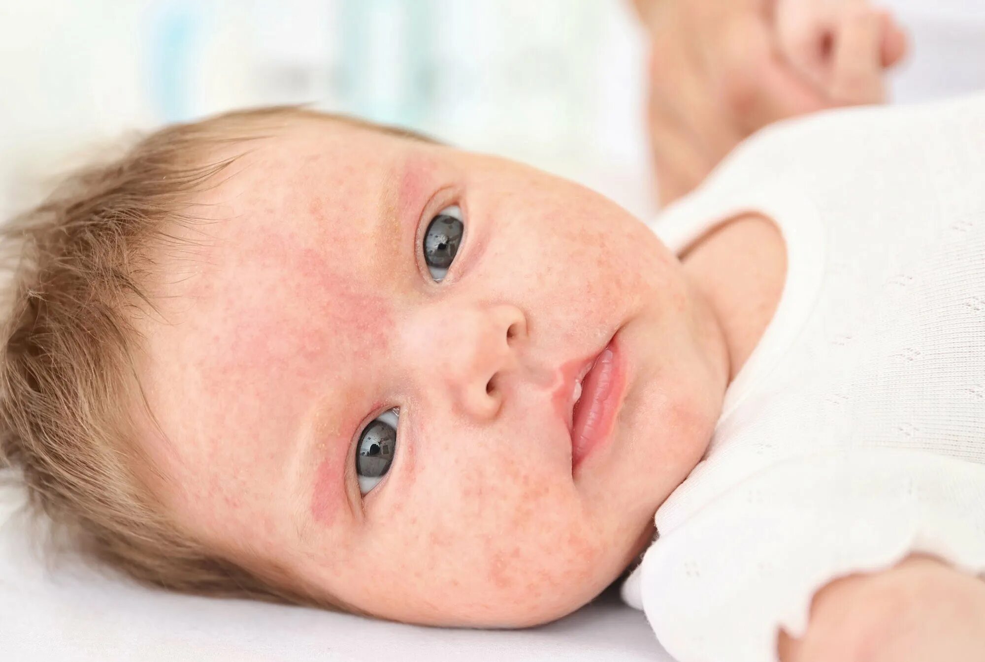 холодная кожа у ребенка