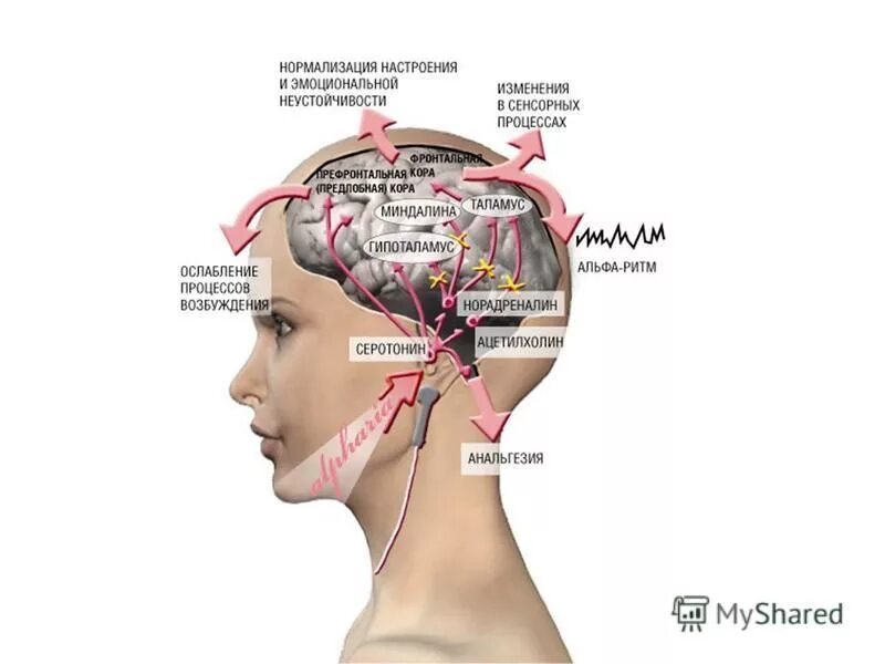 Стимуляция мозга ребенка. Транскраниальная магнитная стимуляция головного мозга аппарат. Аппарат транскраниальной электростимуляции головного мозга. Транскраниальная электростимуляция (ТЭС). Методика транскраниальной электростимуляции.