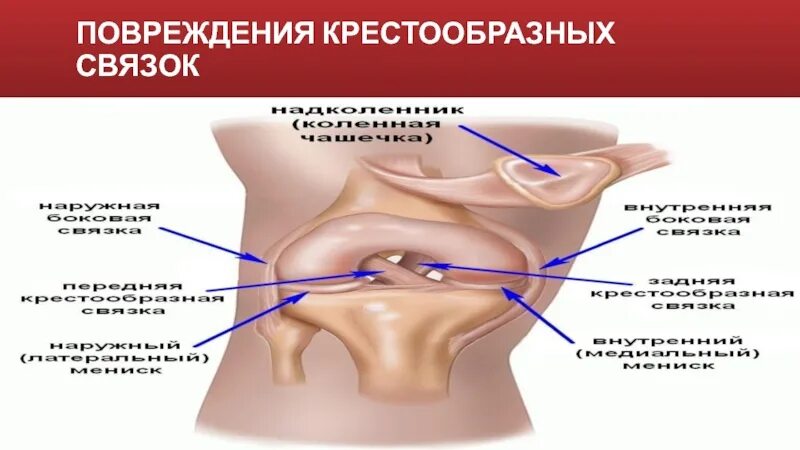 Капсульно связочный аппарат. Повреждение капсульно-связочного аппарата. Капсульно-связочный капсульно-связочный аппарат. Повреждение капсульного связанного аппарата.